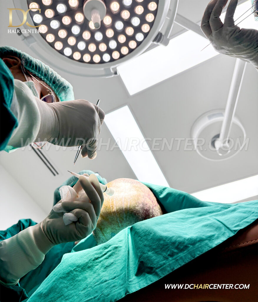 DC Hair Center ศูนย์ปลูกผมถาวรเชียงใหม่ (Hair Transplant Center in Chiang Mai)