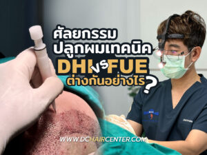 ปลูกผม DHI กับ FUE ต่างกันยังไง ปลูกผมแบบไหนดี